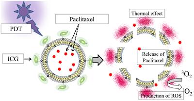 Photodynamic therapy with paclitaxel-encapsulated indocyanine green-modified liposomes for breast cancer